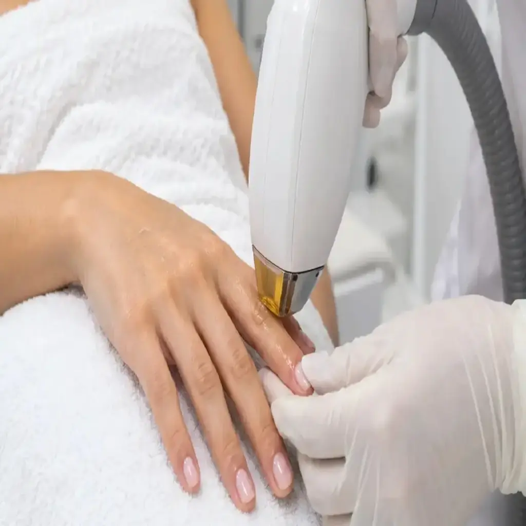 DEPILACIÓN LASER - DEDOS DE MANO