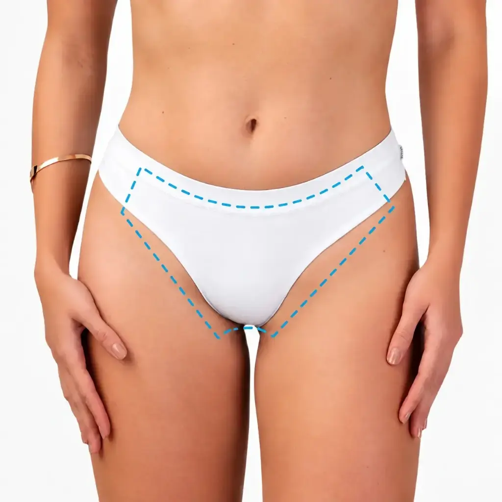 DEPILACIÓN LASER - BIKINI COMPLETO