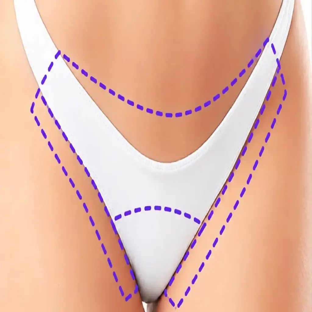 DEPILACIÓN LASER - BIKINI TRADICIONAL